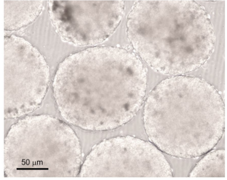 Patient-derived tumor organoids as a platform of precision treatment for malignant brain tumors